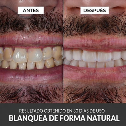 LÜMA Teeth™ Pasta Dental de Nano-Hidroxiapatita